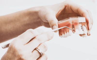 Types of Dental Implants