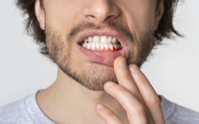 Your Gums Are Bleeding. Now What?