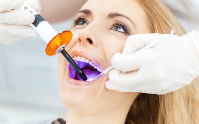 Are You Up To Date On Teeth Whitening Costs? Here’s What You Need To Know!