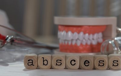 Understanding an Abscessed Tooth: Causes, Symptoms, and Treatment Options