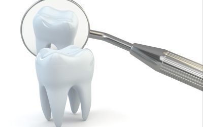 A Comprehensive Guide to Basic Dental Procedures