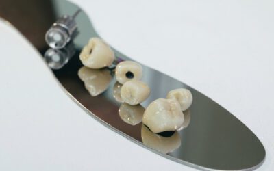 Do Crowns Break Easily? Understanding Dental Crown Durability