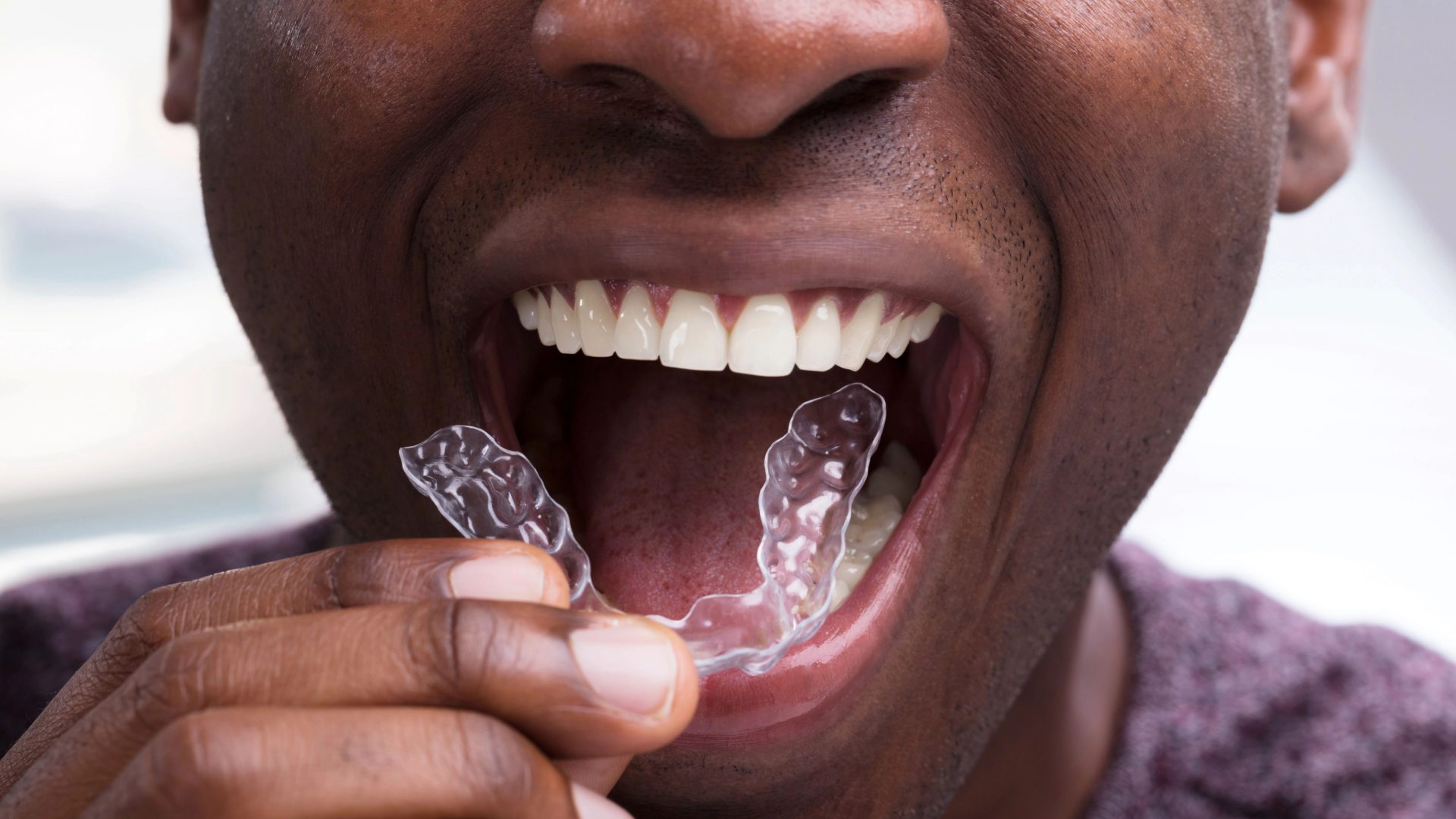 Patient Empowered Dentistry - Why Do I Get a Toothache When I Bite Down Understanding the Causes and Solutions - Preventing Bite Pain Before it Starts Dental Implant